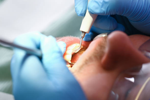 Best Tooth Pain Emergency Relief  in Carrier Mls, IL