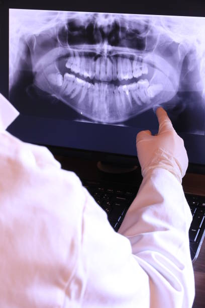 Best Dentist for Tooth Abscess  in Carrier Mls, IL